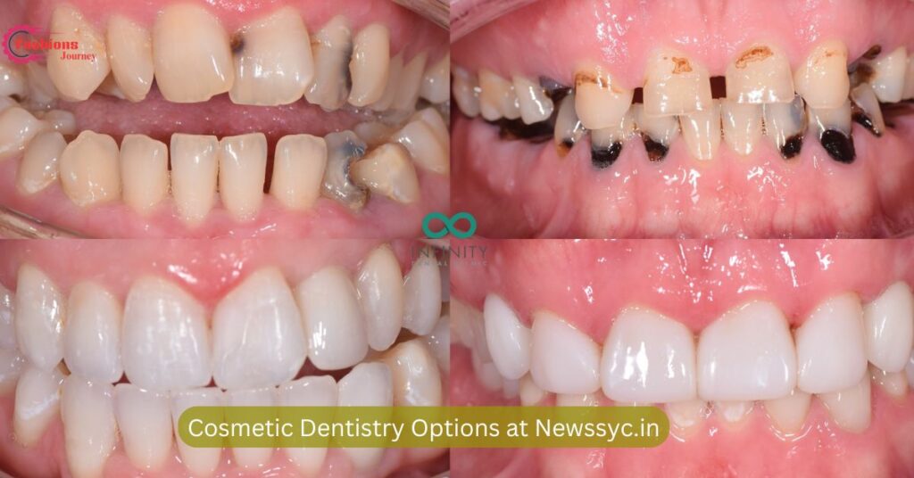 Cosmetic Dentistry Options at Newssyc.in